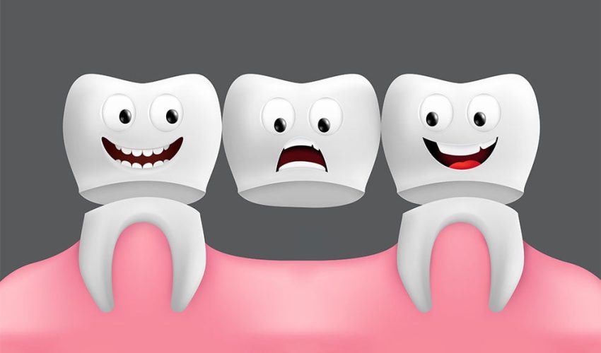 Ponte Fixa vs IMplante dentário