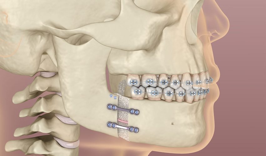 Relações maxila e mandíbula em dentados 